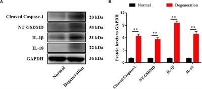 miRNA-141 Induced Pyroptosis in Intervertebral Disk Degeneration by Targeting ROS Generation and Activating TXNIP/NLRP3 Signaling in Nucleus Pulpous Cells